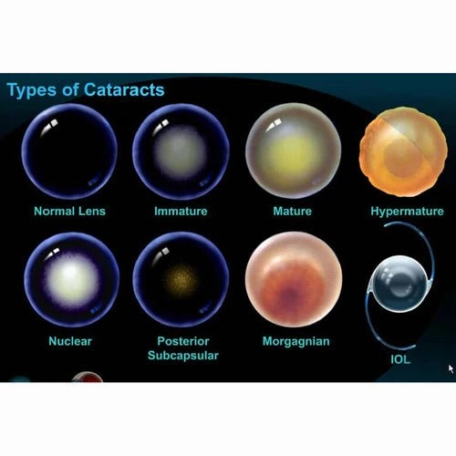 Lanomax Cataract-Dissolving Lanosteral Eye Drops for Dogs & Cats